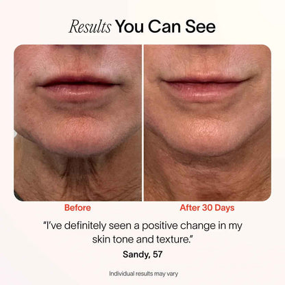 4-In-1 Radiant Renewal Skincare Wand with Red Light Therapy