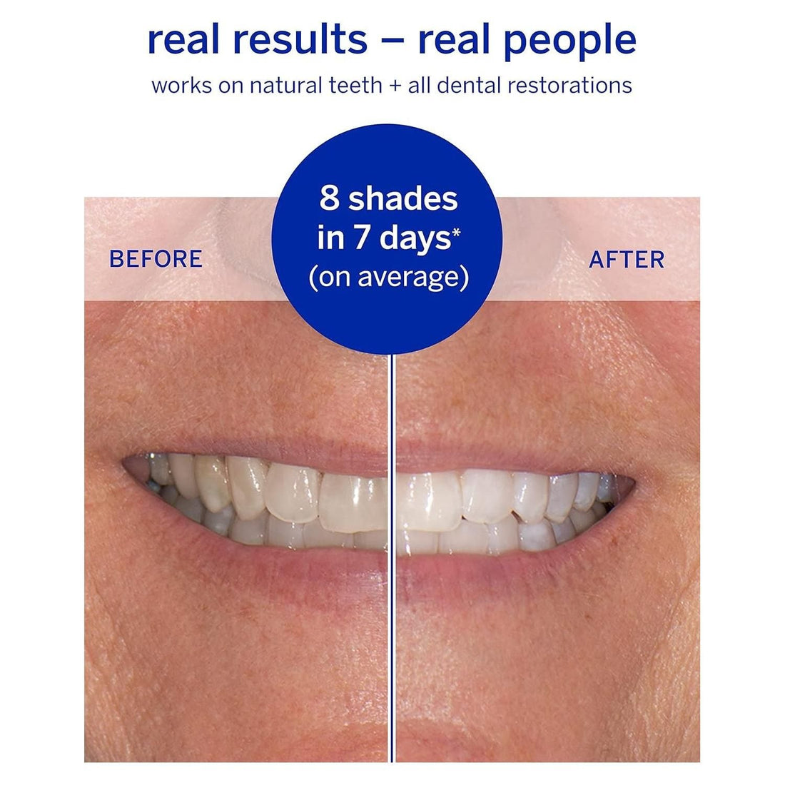 Supersmile Superstrips Teeth Whitening Dissolving Strips 14 by Pasteur Pharmacy