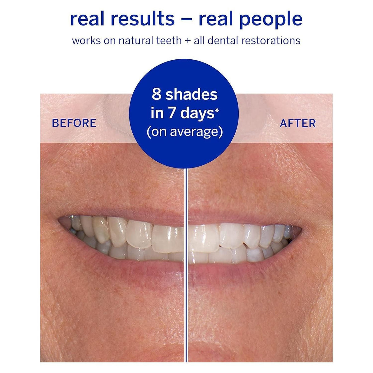 Supersmile Superstrips Teeth Whitening Dissolving Strips 14 by Pasteur Pharmacy