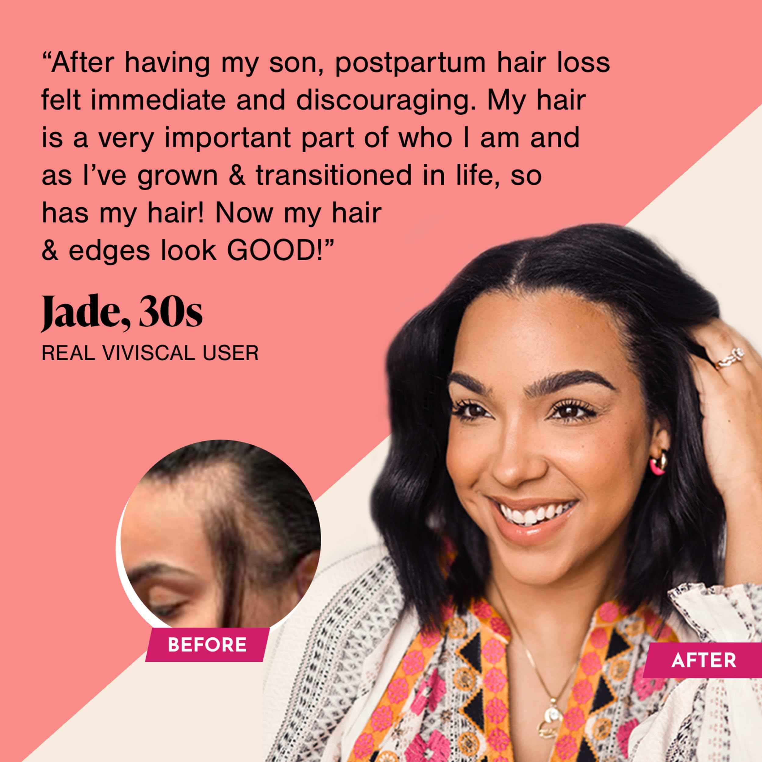 Viviscal Hair Growth Supplements For Women For Thicker, Fuller Hair, Nourishes Thinning &amp; Loss, With Proprietary Collagen Complex, 180 Tablets, 3 Month Supply