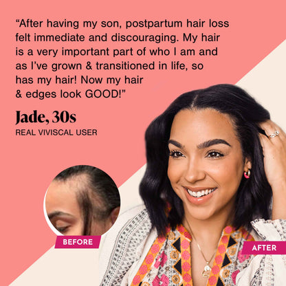 Viviscal Hair Growth Supplements For Women For Thicker, Fuller Hair, Nourishes Thinning &amp; Loss, With Proprietary Collagen Complex, 180 Tablets, 3 Month Supply