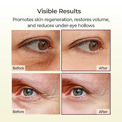 Dr.Melaxin Cemenrete Calcium Multi Balm 9g Korean Skin Care All In One Calcium Volume Stick Collagen Wrinkles Face Eye treatment Balm  DestGlow