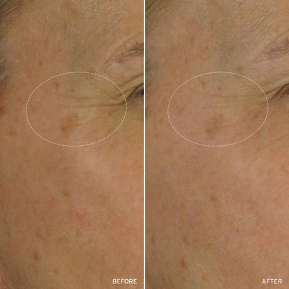 NAD+ CELL ENERGIZING TREATMENT