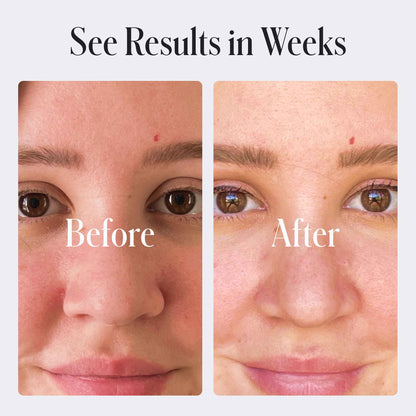 Skin Repair Moisturizer