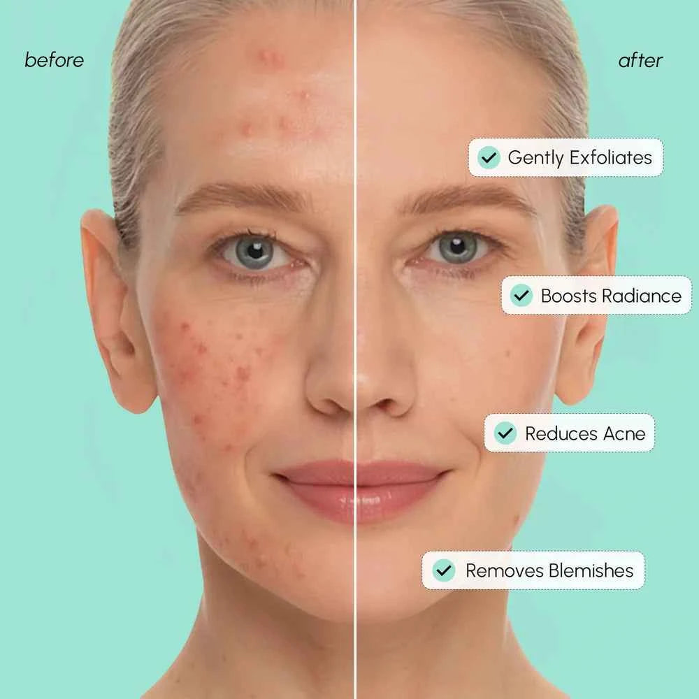 Azelaic Acid Soothing Pads