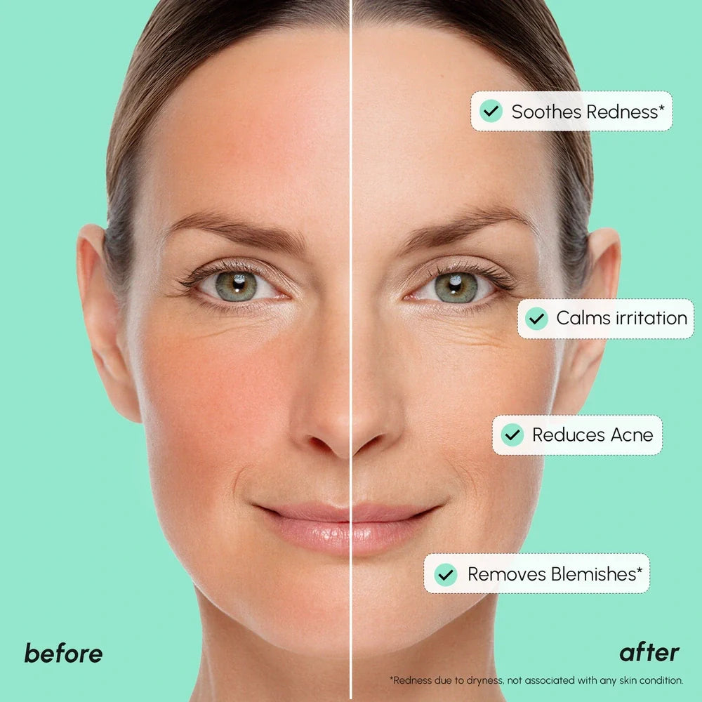 Redness Soothing Azelaic Acid Serum by Maree