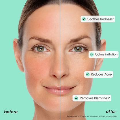 Redness Soothing Azelaic Acid Serum by Maree