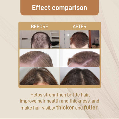 Googeer Dense Hair Dietary Supplement Drops Nourishes Roots, Prevents Breakouts And Strengthens Hair Care Supplements