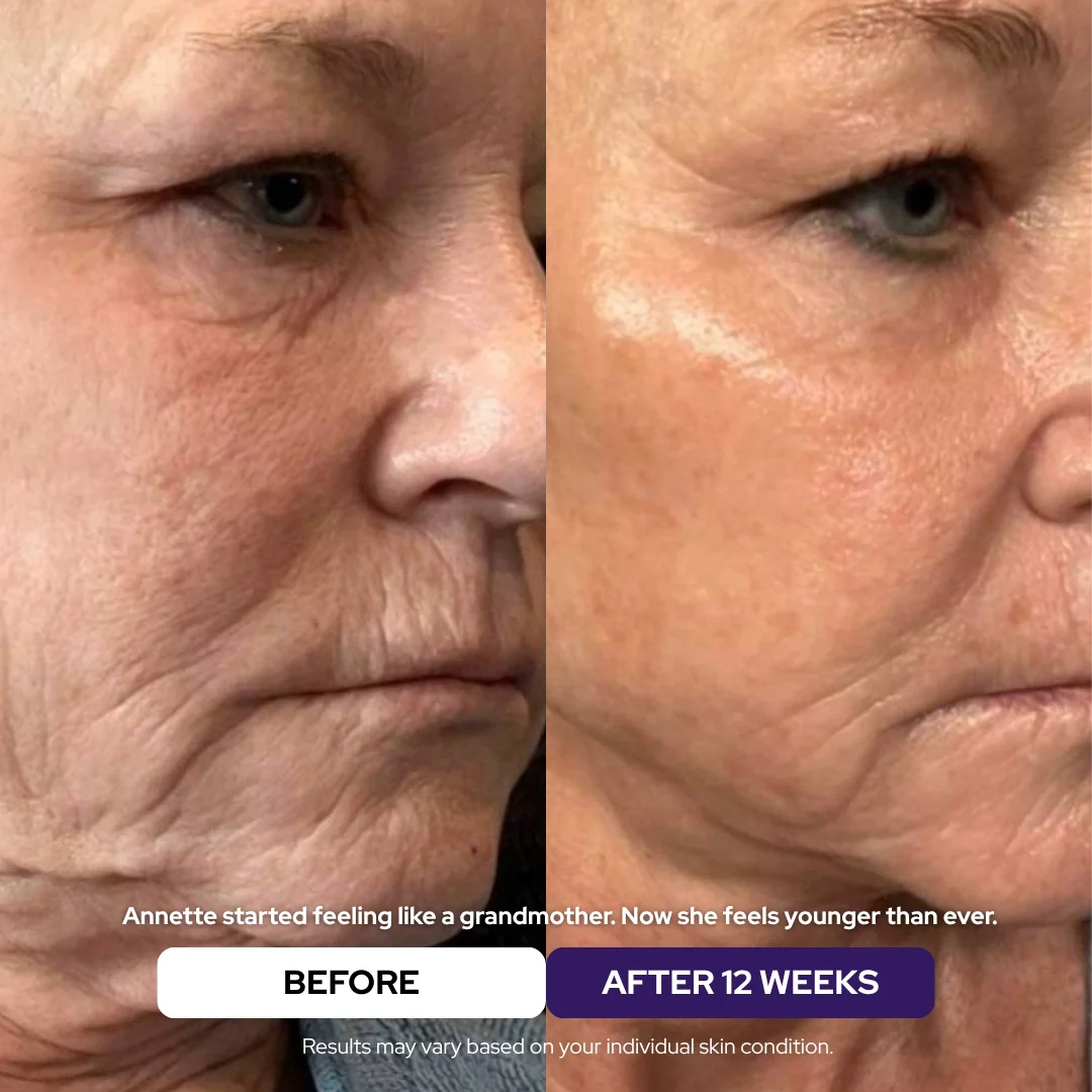 Collagen &amp; Niacinamide wrapping mask - DestGlow