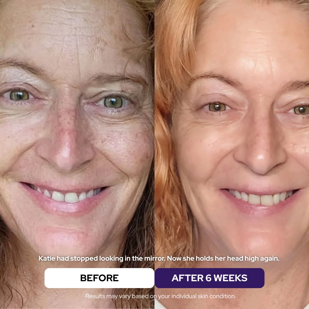 Collagen &amp; Niacinamide wrapping mask - DestGlow