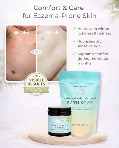 Eczema Baby Skincare Duo by Irene Organics