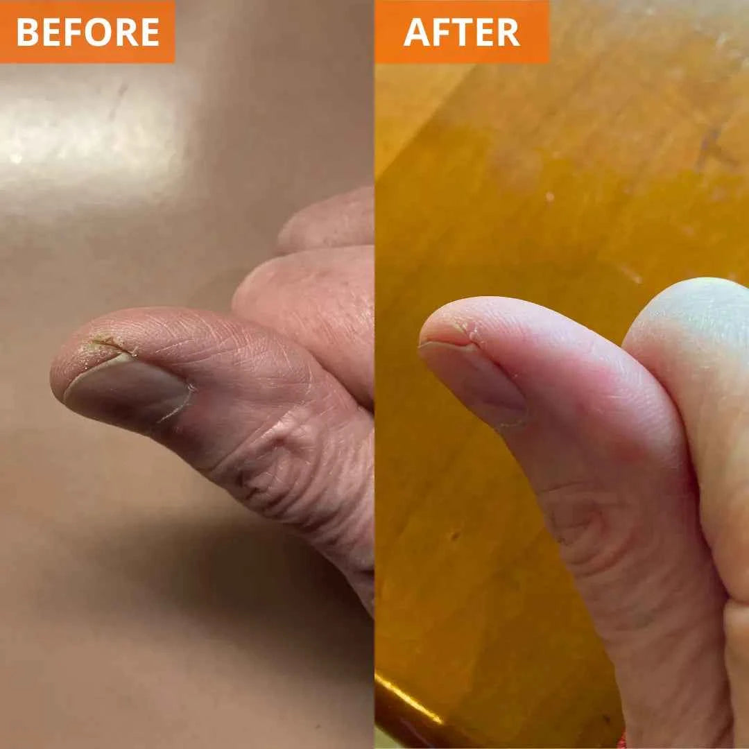 Moisturizing Skin Cream 4.4 Fl. Oz. Jar