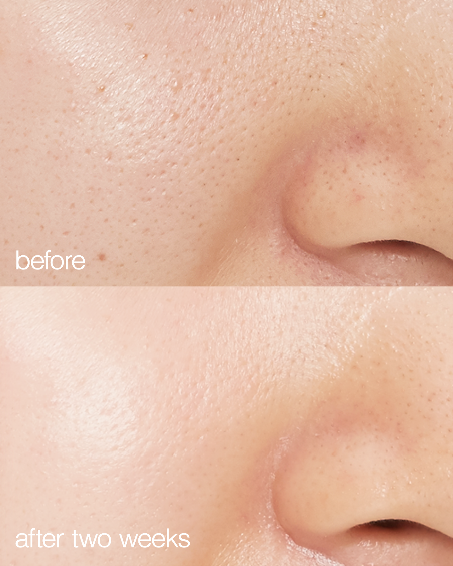 Biome Boost Cream Daily Moisturizer  DestGlow
