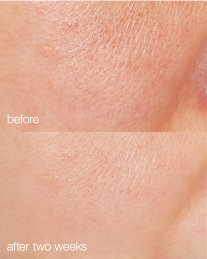 Biome Boost Cream Daily Moisturizer