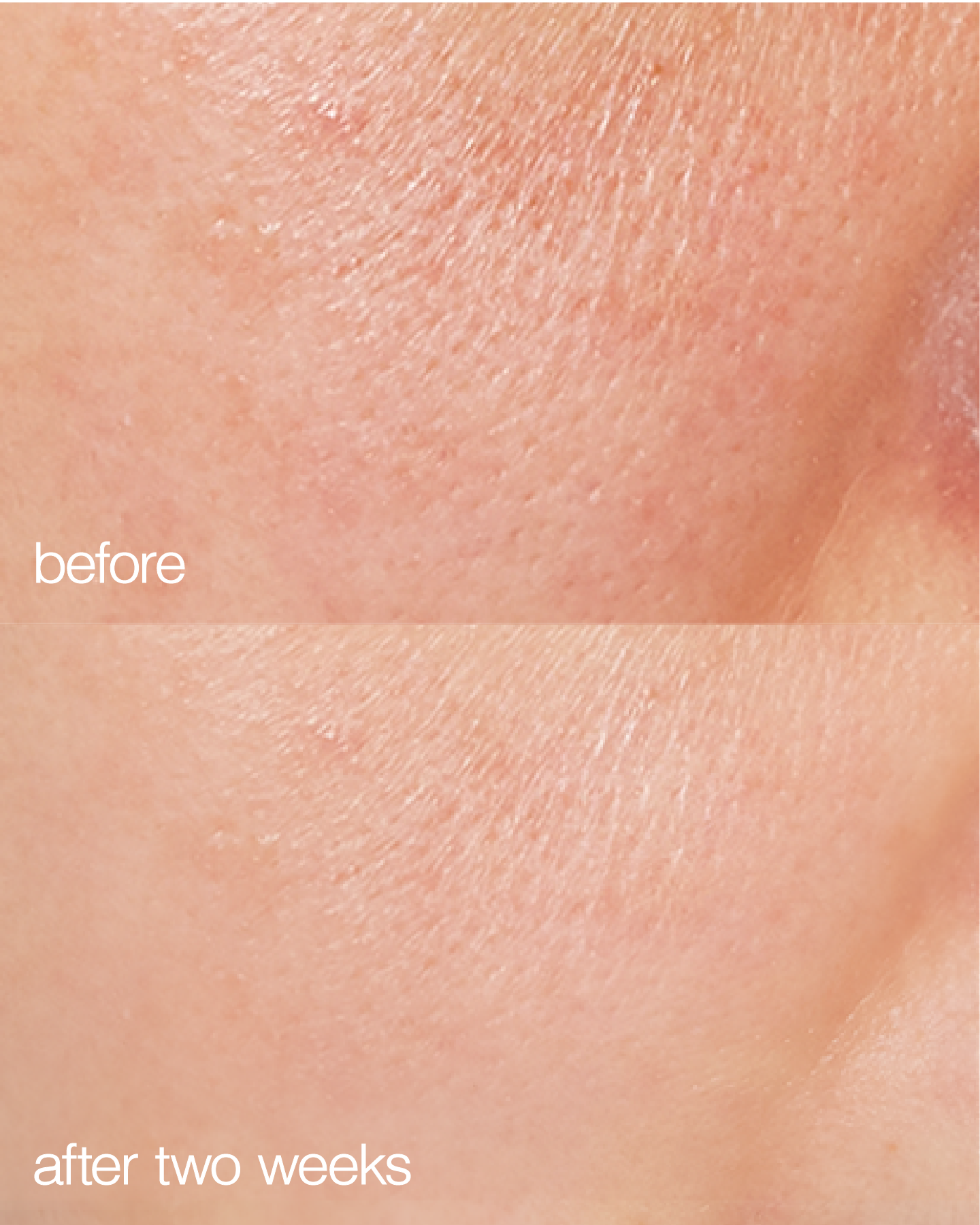 Biome Boost Cream Daily Moisturizer  DestGlow