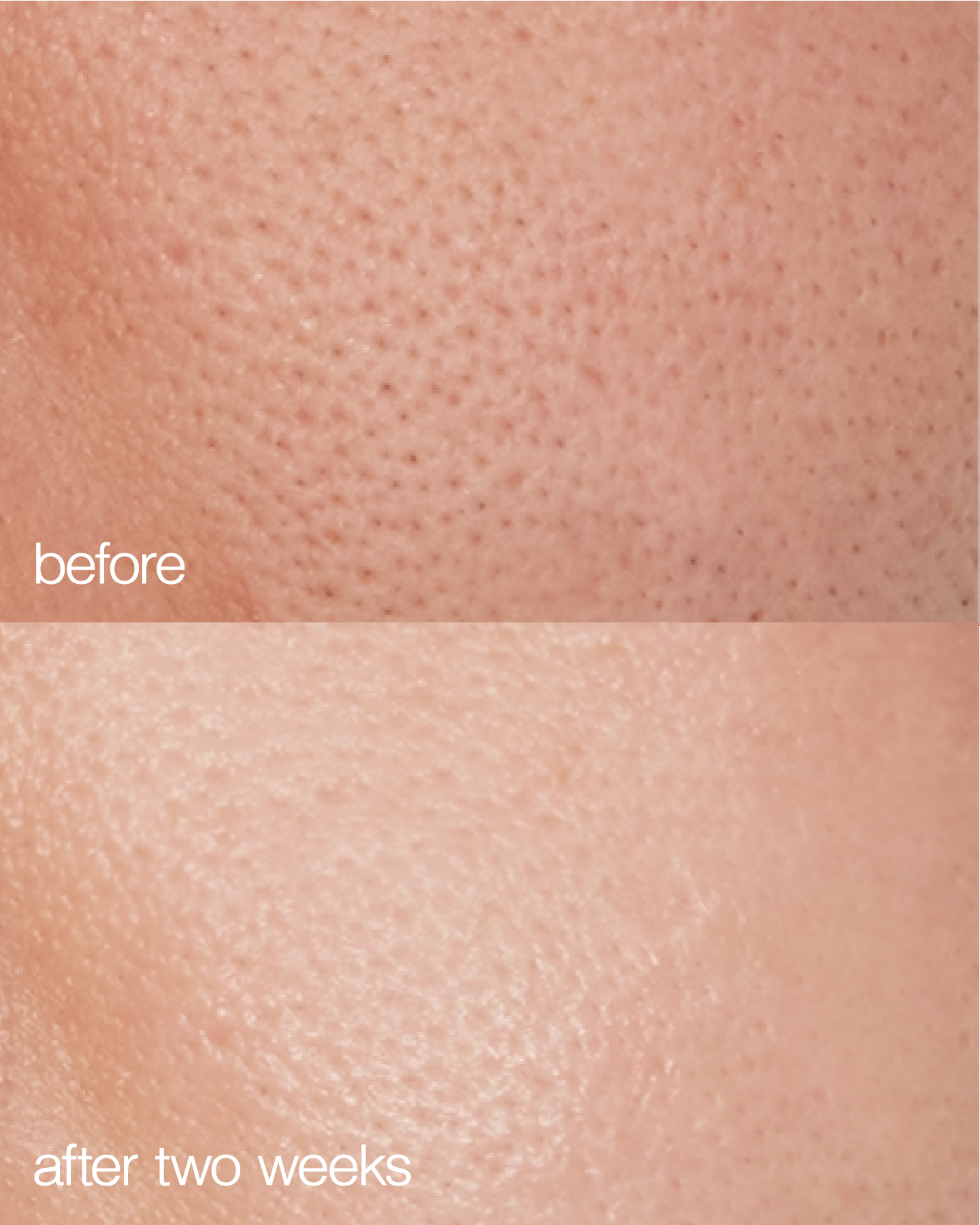 Biome Boost Cream Daily Moisturizer  DestGlow