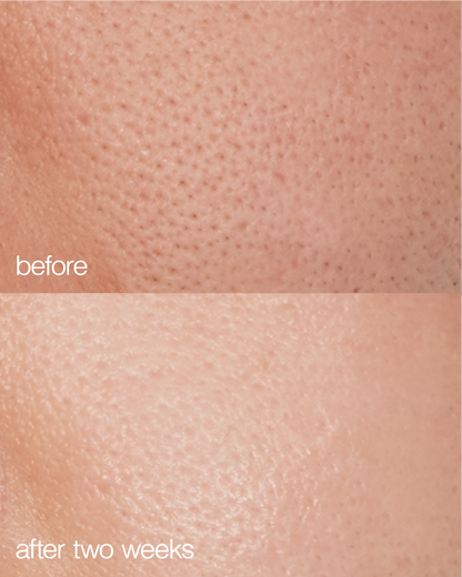 Biome Boost Cream Daily Moisturizer  DestGlow
