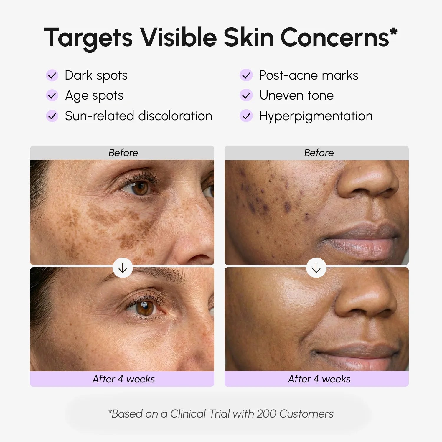 Face &amp; Body Serum for Dark Spots by Maree