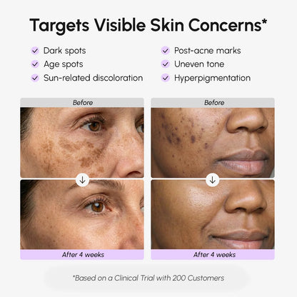 Face &amp; Body Serum for Dark Spots by Maree