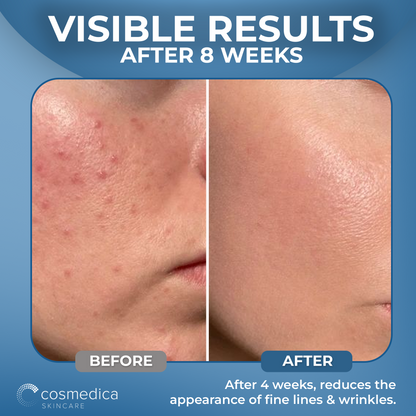 Hyaluronic Acid +Vitamin B5 Serum by Cosmedica Skincare