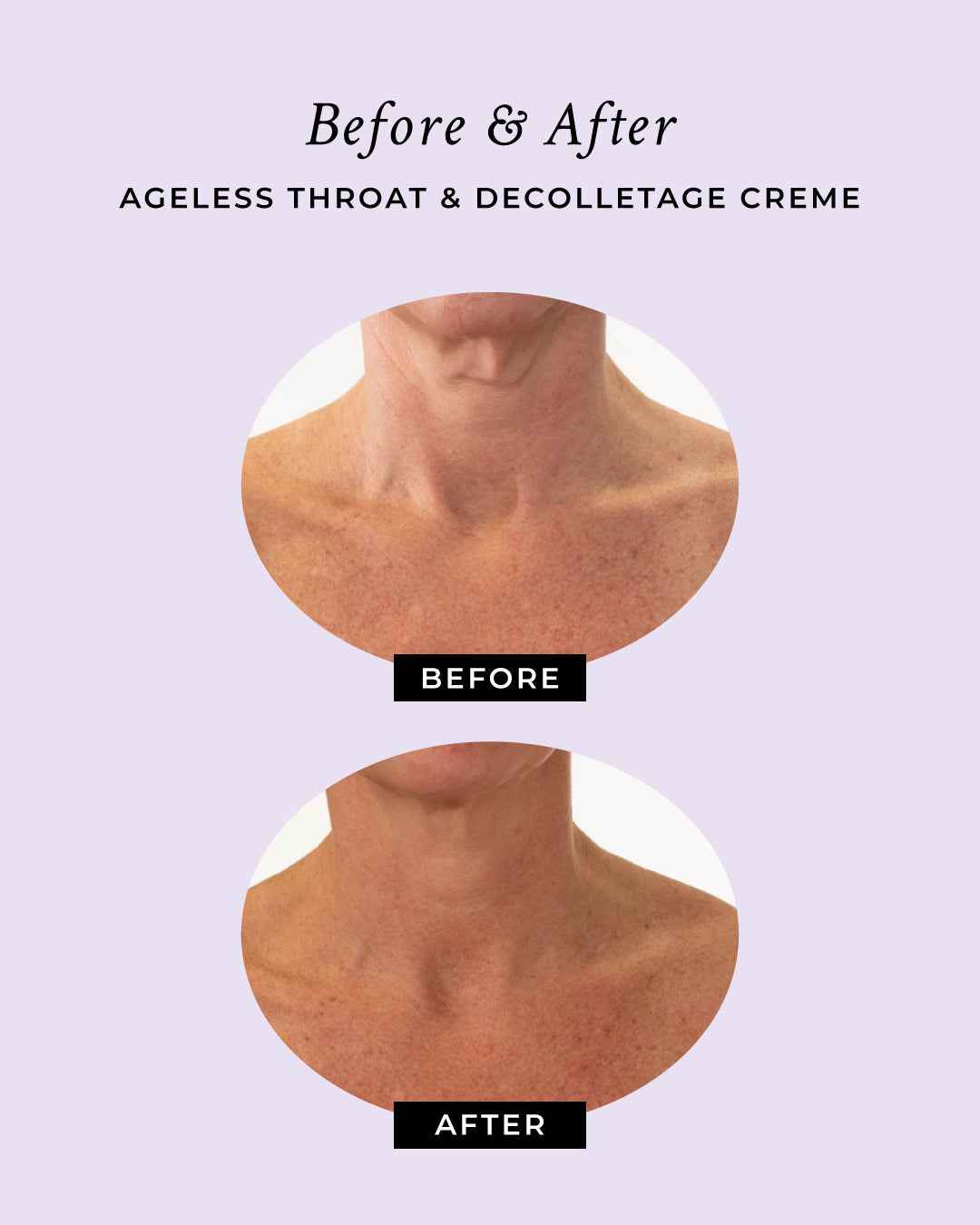 Ageless Throat &amp; Decolletage Anti-Aging Neck Creme