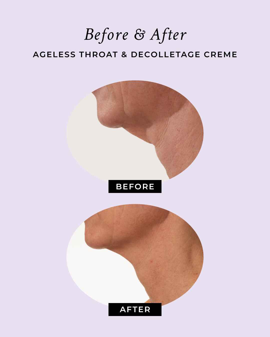 Ageless Throat &amp; Decolletage Anti-Aging Neck Creme