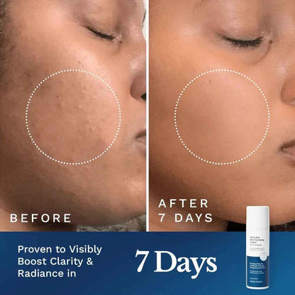 Clear Out Skin Clarifying Cream