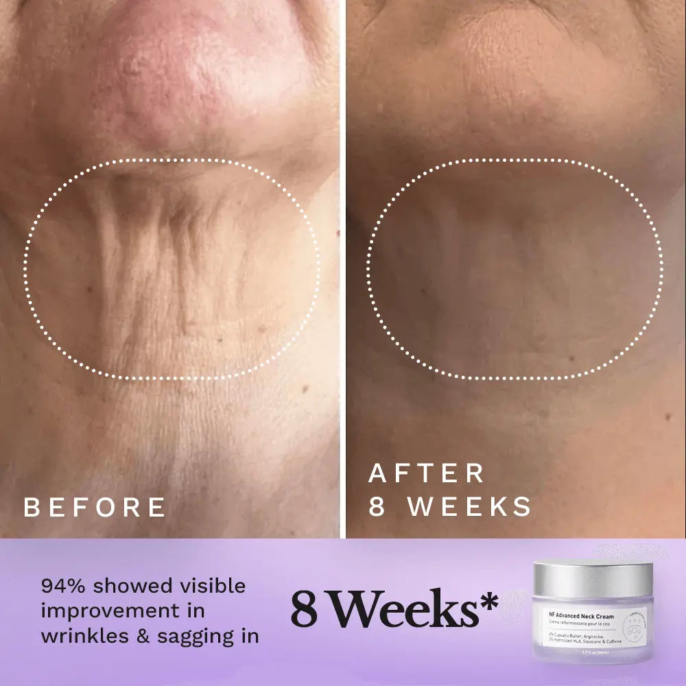 NF Advanced Neck Cream by Clearly Basics