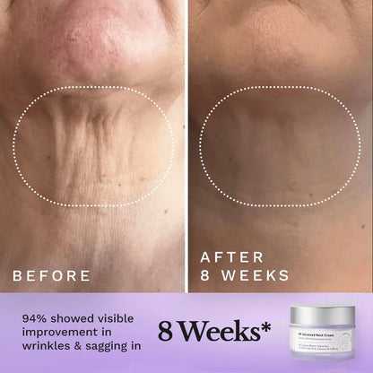 NF Advanced Neck Cream by Clearly Basics