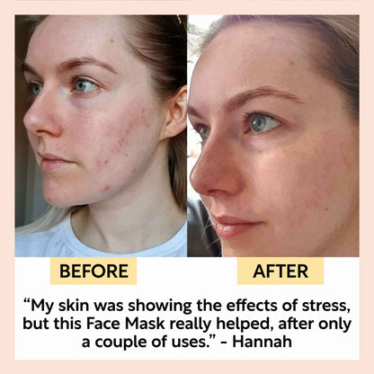 Kaolin Clay Face Mask