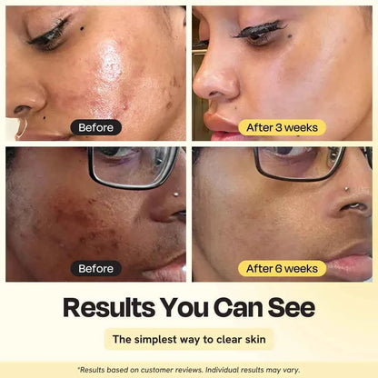 Jumbo Vitamin C Clay Mask