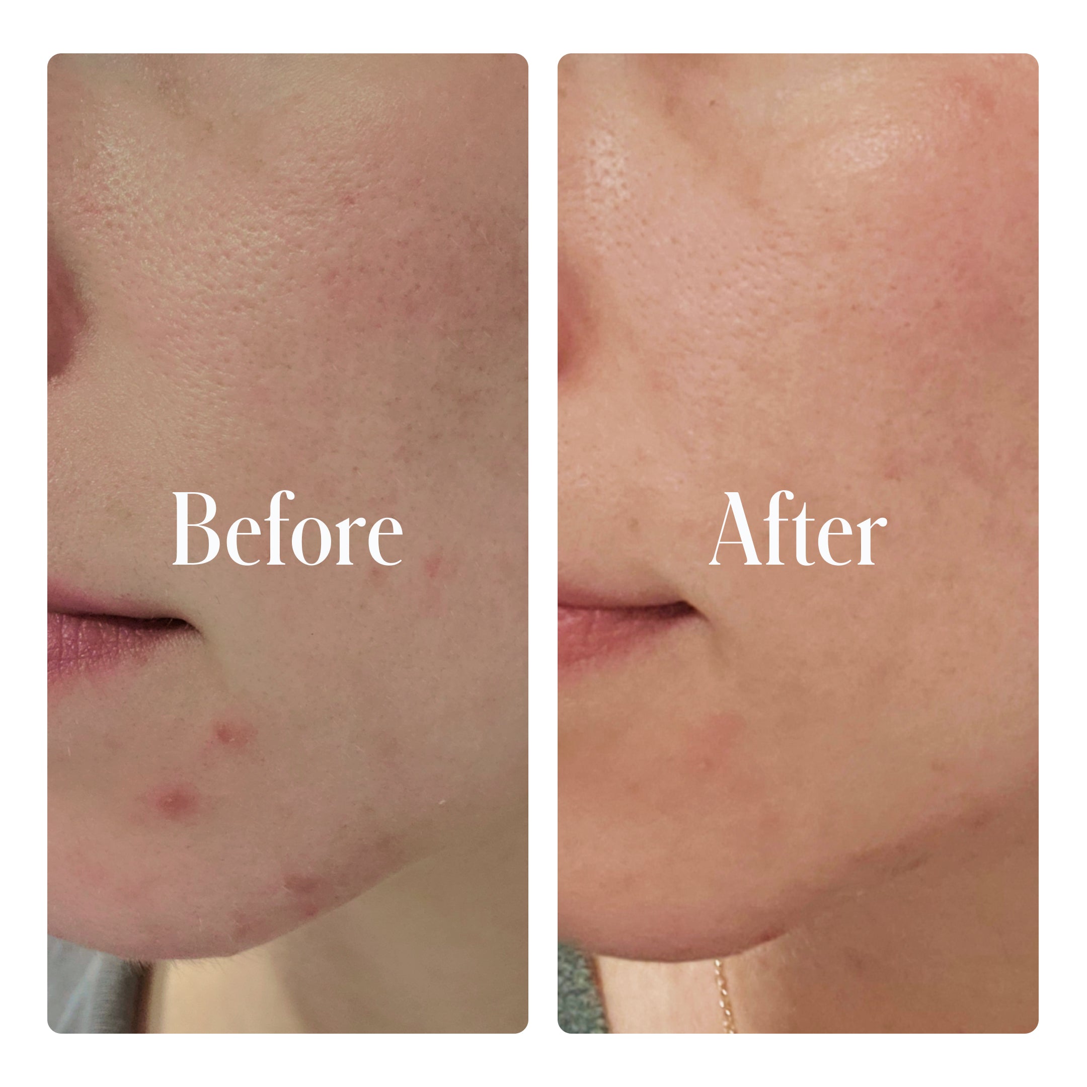 Clear System Full Routine by Geologie