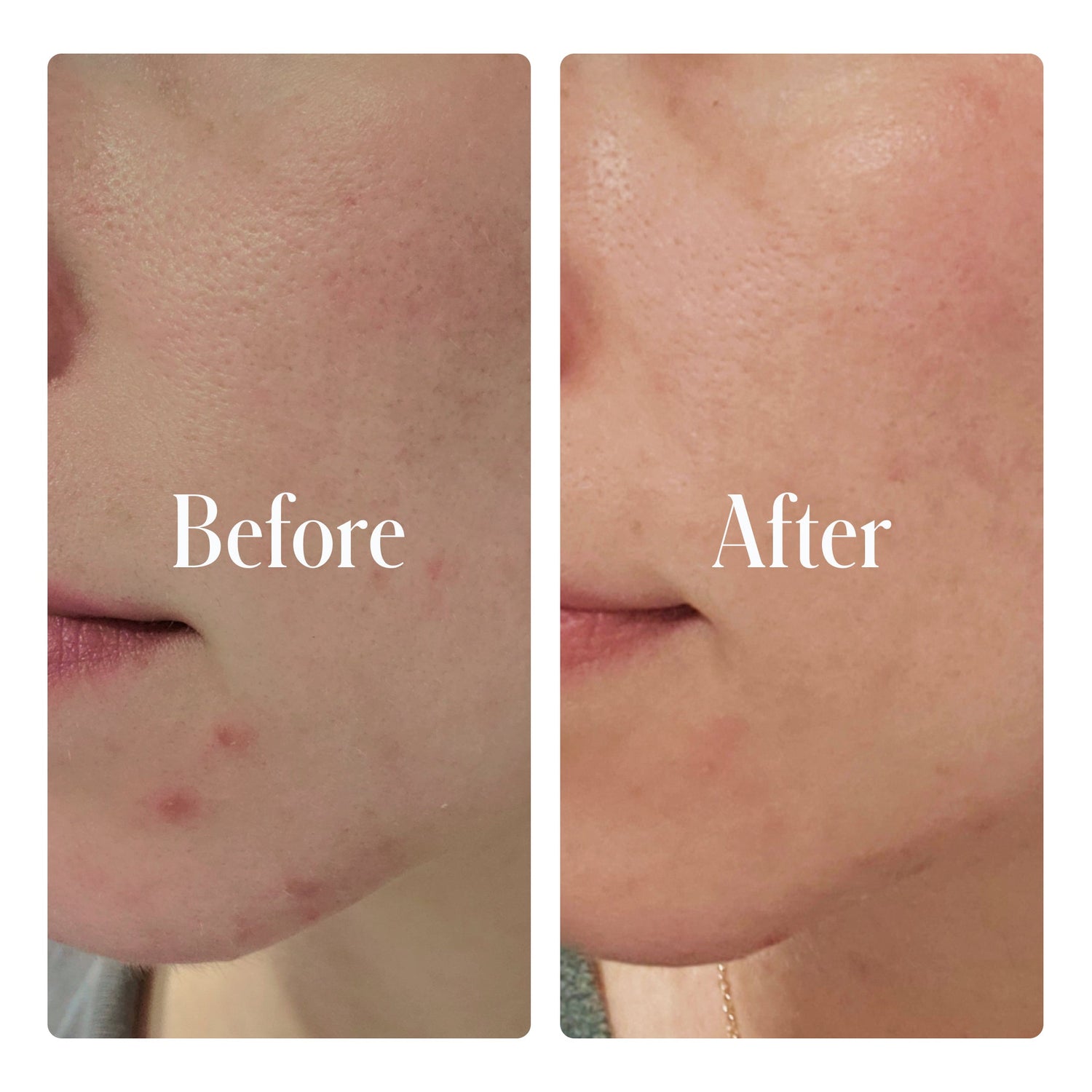 Clear System Face Routine by Geologie