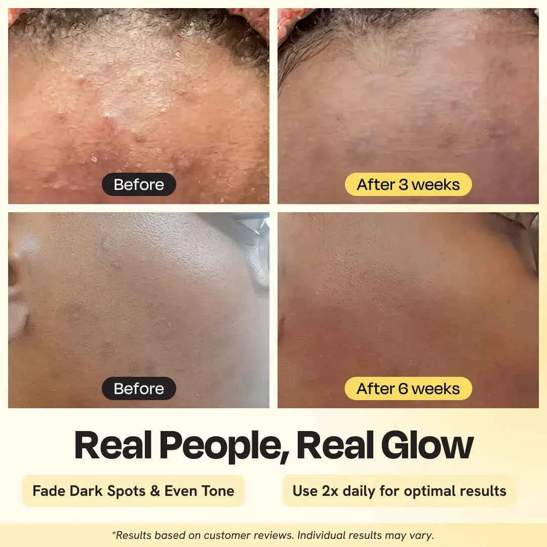 Advanced Brightening Moisturizer