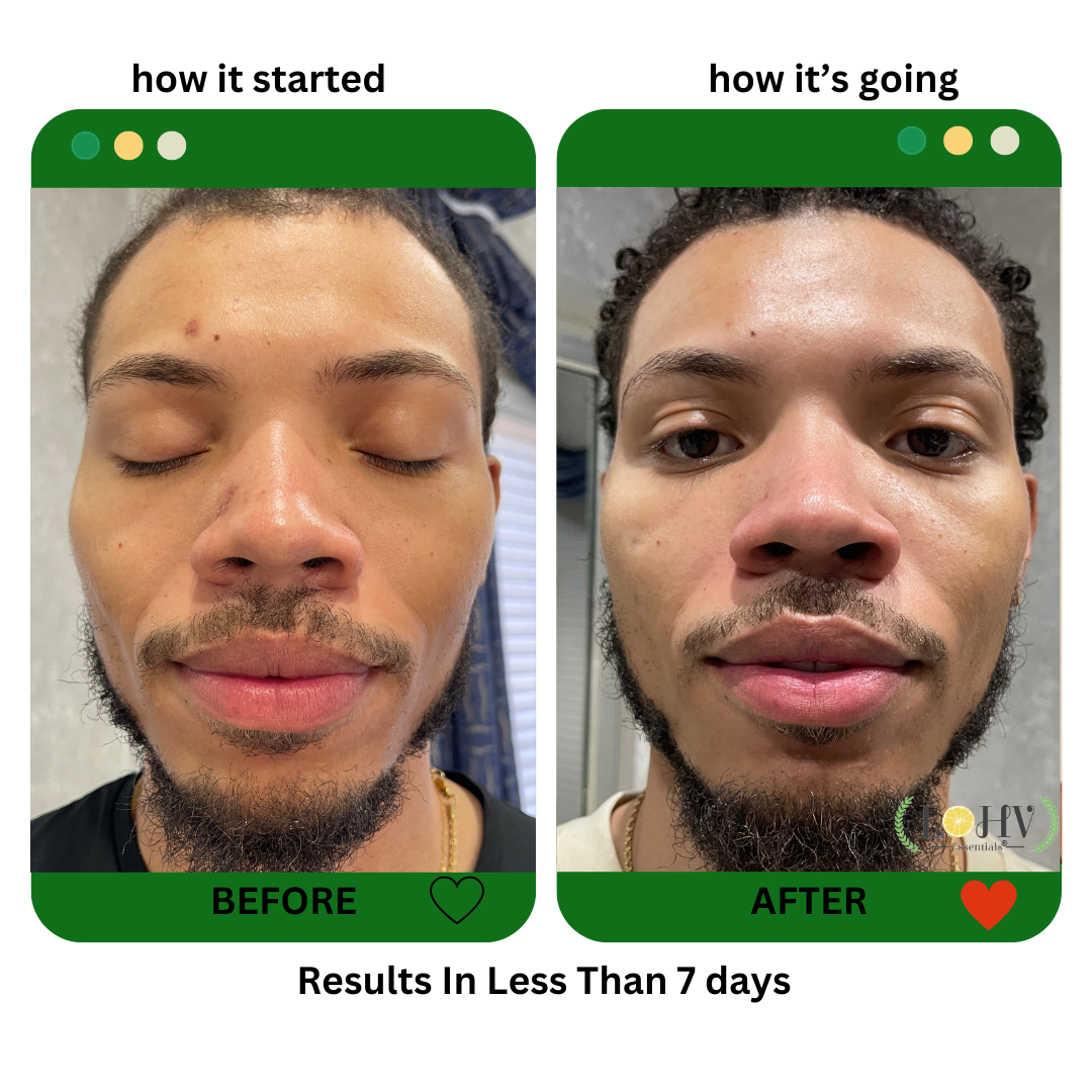 PREMIUM 100% VEGAN Rejuvenating JELLY FACE MASK With Retinol + Turmeric + Aloe Vera + Lactic acid + Rosemary Leaf