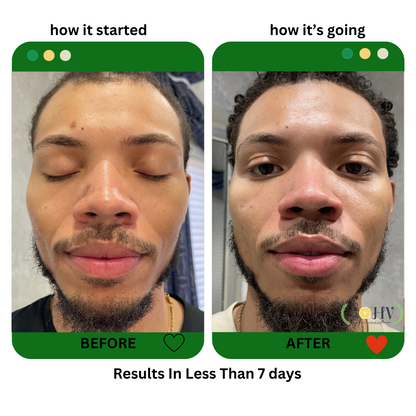 PREMIUM 100% VEGAN Rejuvenating JELLY FACE MASK With Retinol + Turmeric + Aloe Vera + Lactic acid + Rosemary Leaf