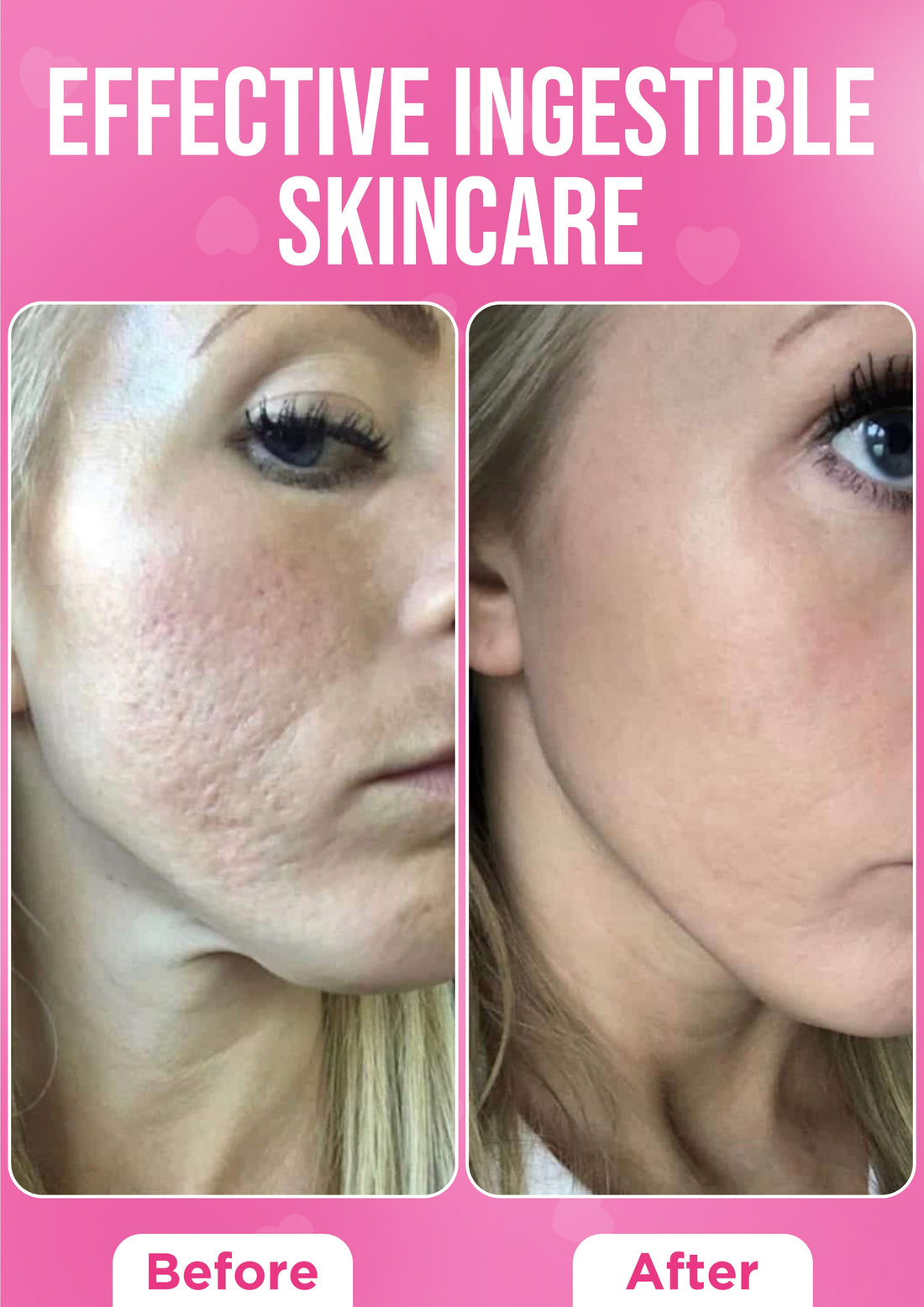 It Girl Skin – Skin Food  DestGlow