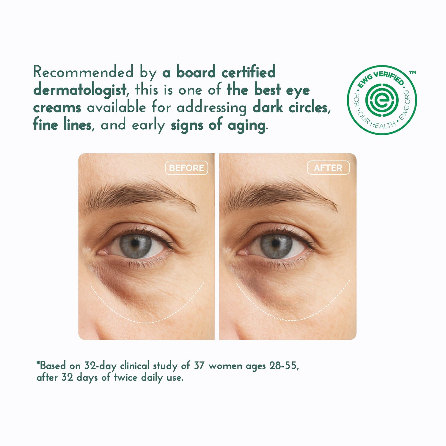 Eye &amp; Neck Cream for Dark Circles and Wrinkles by Honest &amp; Pure