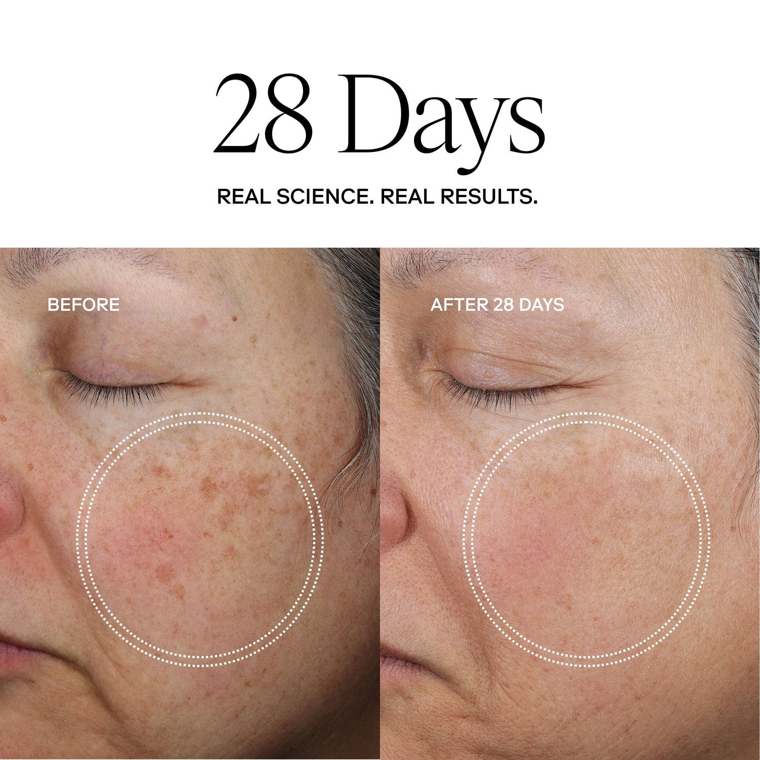EXO FACE® Perfection Moisturizer / eXo³ Exosomes® by Exoceuticals