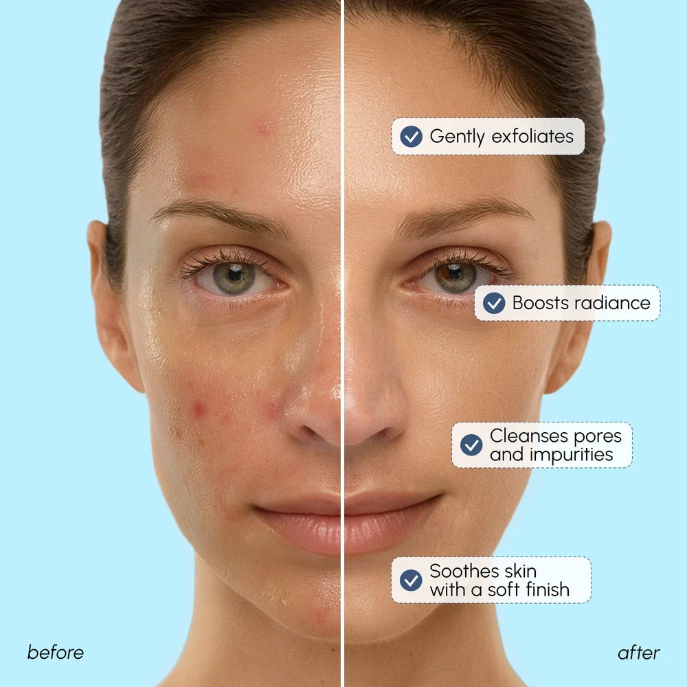 Face Polishing Scrub &amp; Exfoliator 