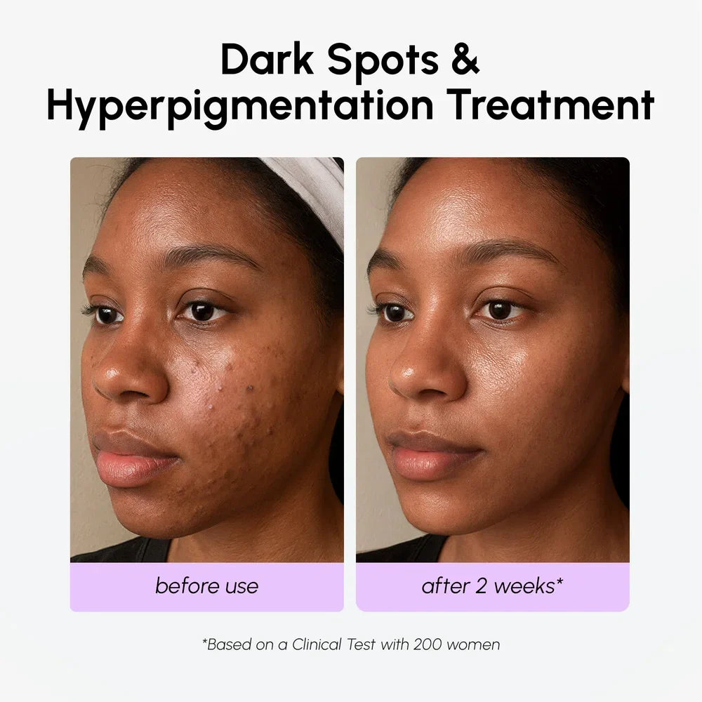 Dark Spot Corrector by Maree
