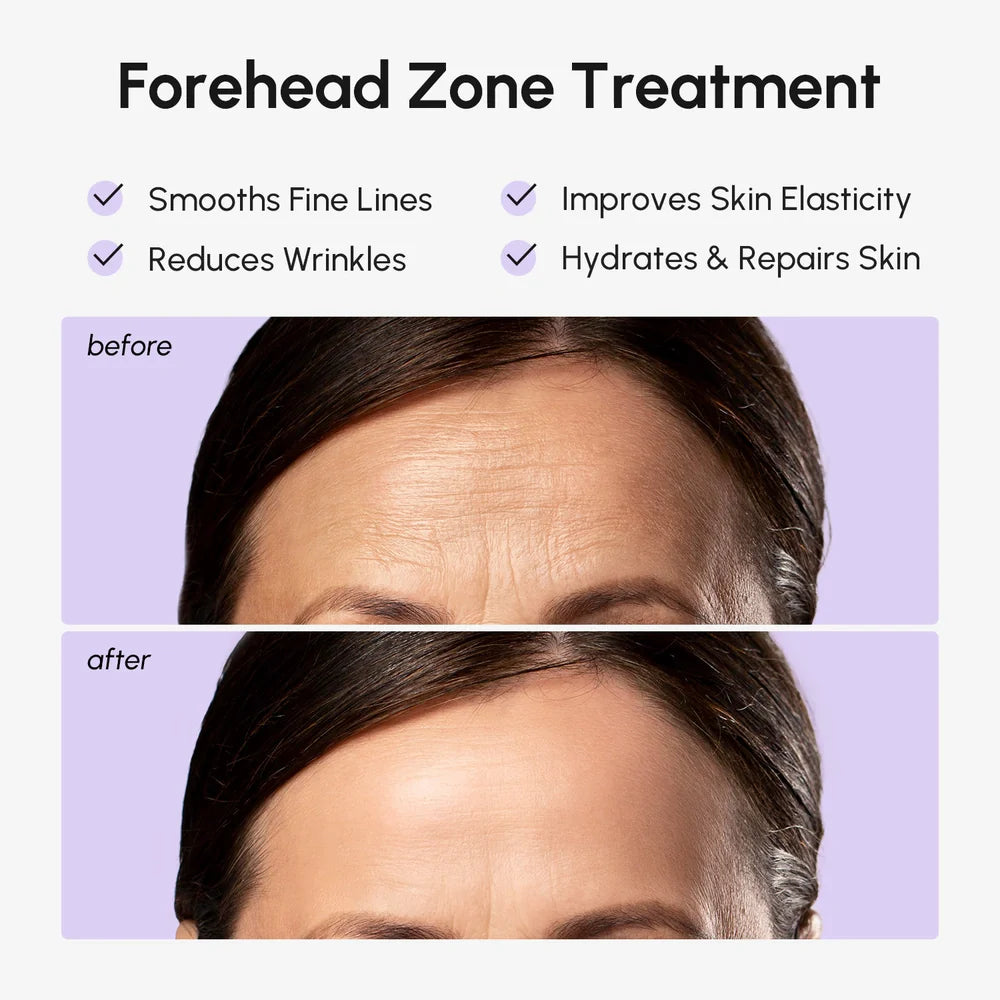 Anti-Wrinkle Forehead Patches by Maree