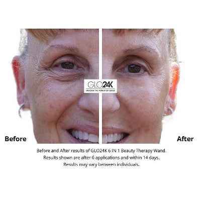 GLO24K 6-in-1 Beauty Therapy Wand for Face Eyes and Neck - New