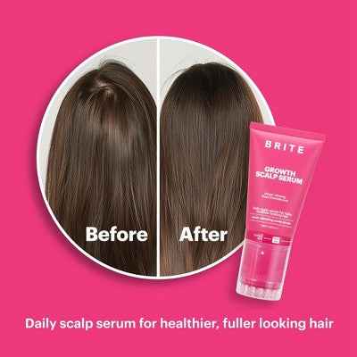 BRITE Growth Scalp Serum with Applicator 3.38 fl oz - Imperfect Box