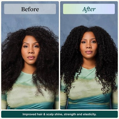 Alodia Nourish and Grow Healthy Hair and Scalp Oil 8.5 fl oz - New by This is Beauty US