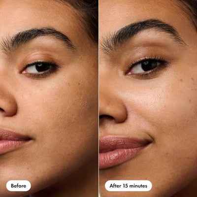 Hero Cosmetics Rescue Patch 6ct - New