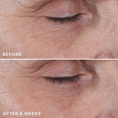 Olay Regenerist Anti-Aging Eye Wrinkle Treatment, Firming &amp; Hydrating 0.68 fl oz - New
