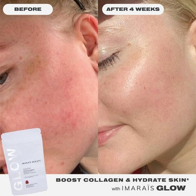 Imarais Beauty Glow Skincare Gummies Vegan and Sugar-Free 30ct - Imperfect Container by This is Beauty US