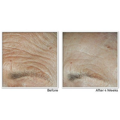 RoC Face &amp; Neck Anti-Aging Moisturizer Firming Cream for Crepey Skin 1.7 fl oz - Imperfect Box