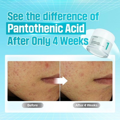 numbuzin No.1 Pantothenic B5 Active Soothing Face Cream 2.7 fl oz - Imperfect Box by This is Beauty US